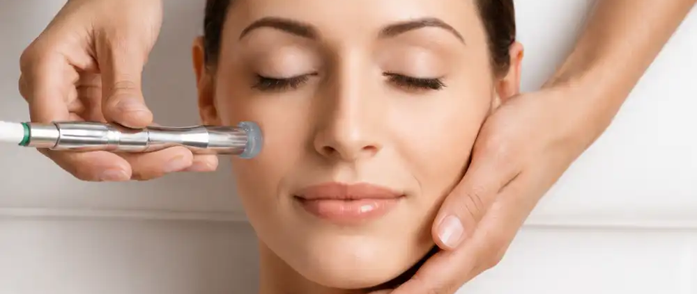 microdermabraziune Crângași efectuată la Artistic Beauty Salon