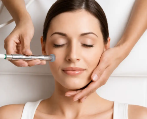 microdermabraziune Crângași efectuată la Artistic Beauty Salon